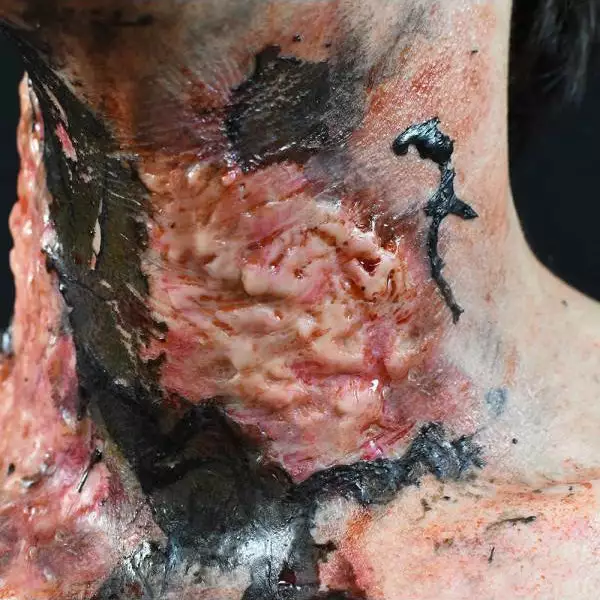 Out Of Kit Burn (Medium) 2 Out Of Kit Burn (Medium)