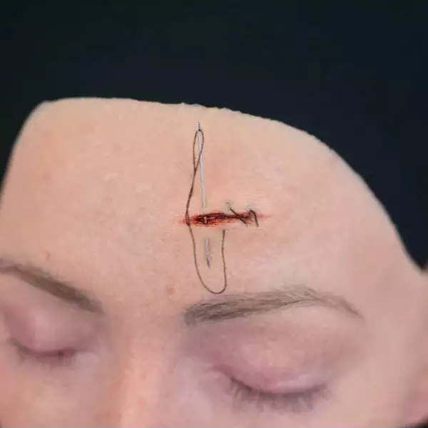 Out Of Kit Stitchable Wound (Small) 2 Out Of Kit Stitchable Wound (Small)