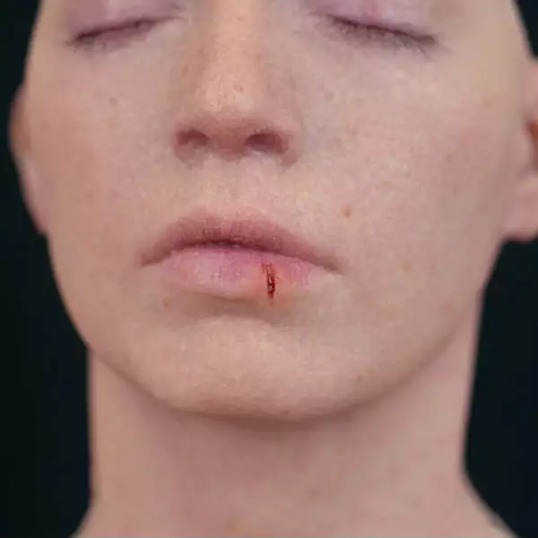 Out Of Kit Split Lip 2 Out Of Kit Split Lip