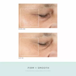 NuFACE Trinity Pro Facial Toning Kit + ELE 16 NuFACE Trinity Pro Facial Toning Kit + ELE