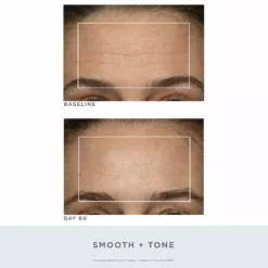 NuFACE Trinity Wrinkle Reducer Red Light Therapy Attachment 10 NuFACE Trinity Wrinkle Reducer Red Light Therapy Attachment