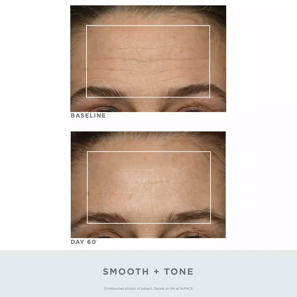 NuFACE Trinity Wrinkle Reducer Red Light Therapy Attachment 5 NuFACE Trinity Wrinkle Reducer Red Light Therapy Attachment