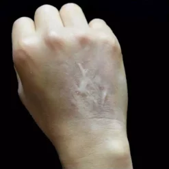 Out Of Kit Healed Burn Scar 1 Special FX