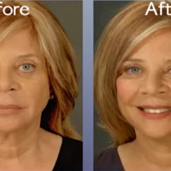 Skincare Art Harding Instant Face And Neck Lift 10 Skincare Art Harding Instant Face And Neck Lift