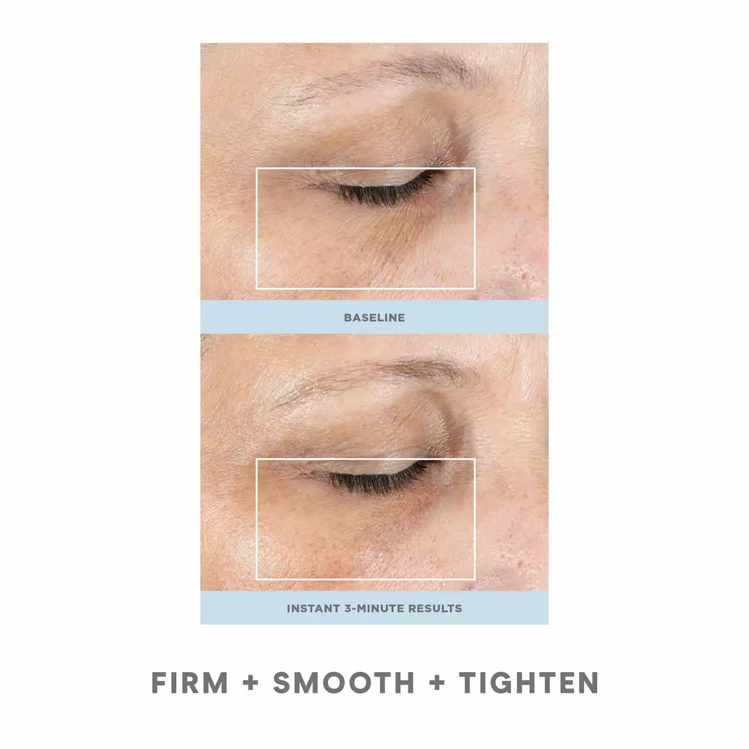 NuFACE FIX 3 NuFACE FIX