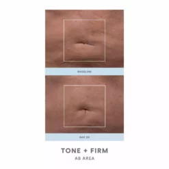 NuFACE NuBODY Toning And Firming Kit 7 NuFACE NuBODY Toning And Firming Kit