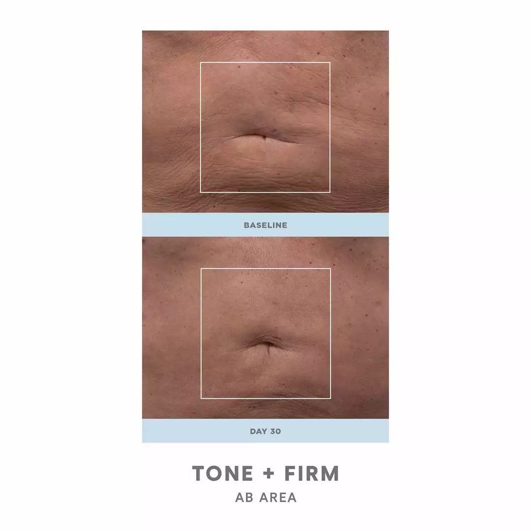 NuFACE NuBODY Toning And Firming Kit 4 NuFACE NuBODY Toning And Firming Kit