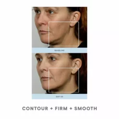 NuFACE Trinity Facial Toning Kit 12 NuFACE Trinity Facial Toning Kit