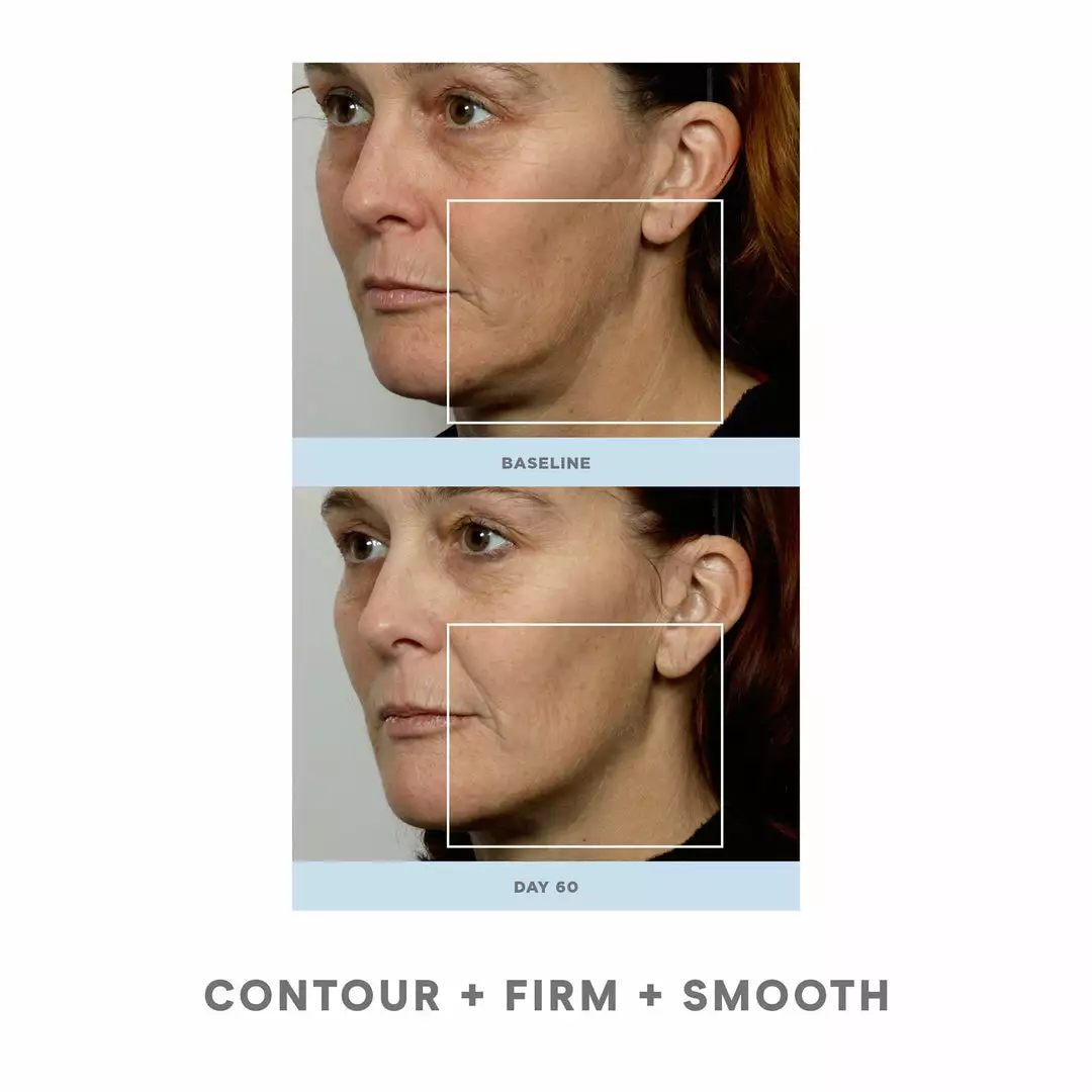 NuFACE Trinity Pro Facial Toning Kit + ELE 4 NuFACE Trinity Pro Facial Toning Kit + ELE