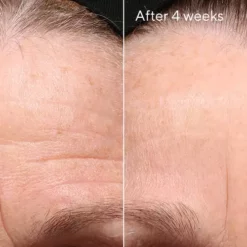 Murad Retinol Youth Renewal Night Cream 5 Murad Retinol Youth Renewal Night Cream