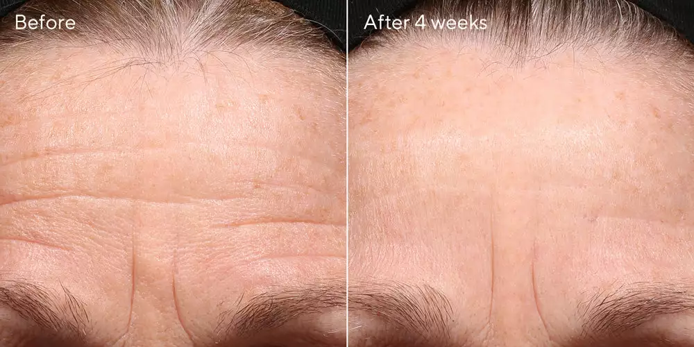 Murad Retinol Youth Renewal Night Cream 3 Murad Retinol Youth Renewal Night Cream