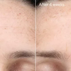 Murad Multi-Vitamin Infusion Oil Skincare 5 Murad Multi-Vitamin Infusion Oil Skincare