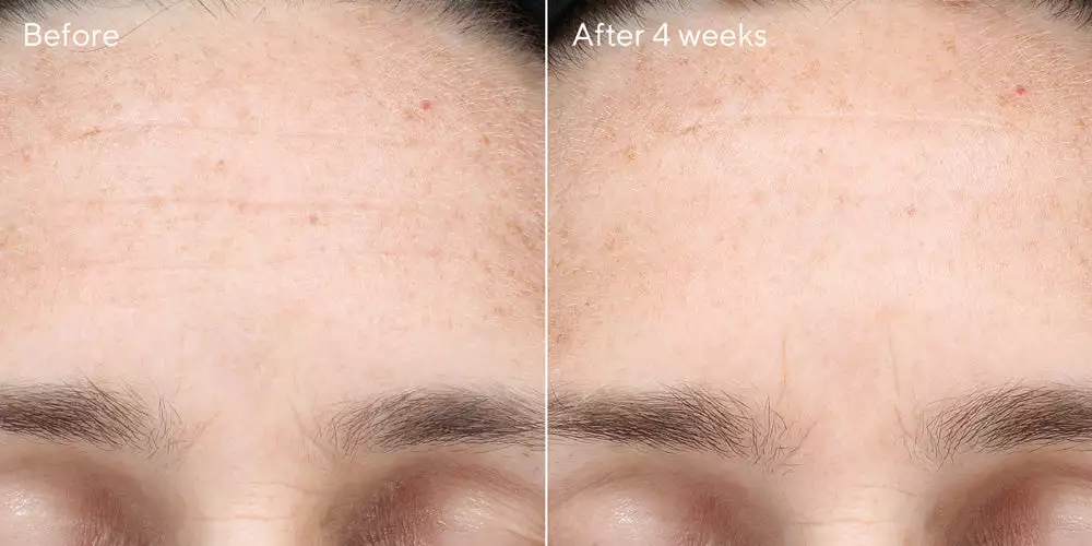 Murad Multi-Vitamin Infusion Oil Skincare 3 Murad Multi-Vitamin Infusion Oil Skincare