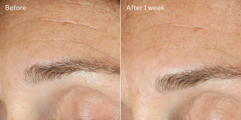 Murad Replenishing Multi-Acid Peel 2 Murad Replenishing Multi-Acid Peel