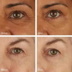 Skincare Skyn Iceland Hydro Cool Firming Eye Gels 8-Pack