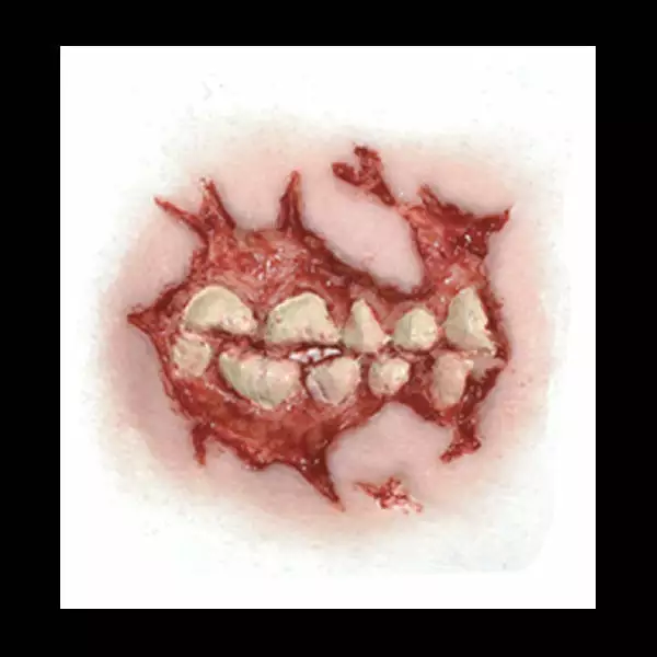 Special FX Tinsley Transfers Cheek Decay - 3D FX Transfer 2 Special FX Tinsley Transfers Cheek Decay - 3D FX Transfer